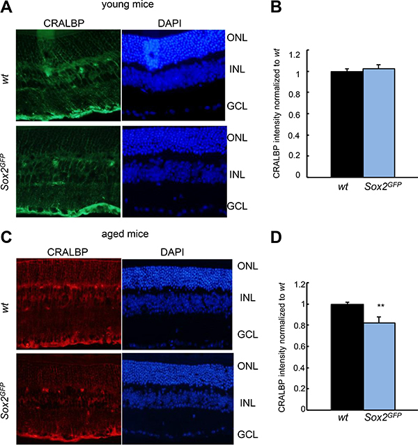 CRALBP expression is reduced in aged Sox2-haploinsufficient mice.