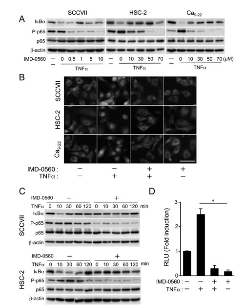 IMD-0560 inhibits TNF&#x3b1;-induced p65 phosphorylation and I&#x3ba;B&#x3b1; degradation in OSCC cells.