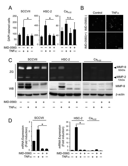IMD-0560 inhibits cell invasion and MMP9 activity in OSCC cells.
