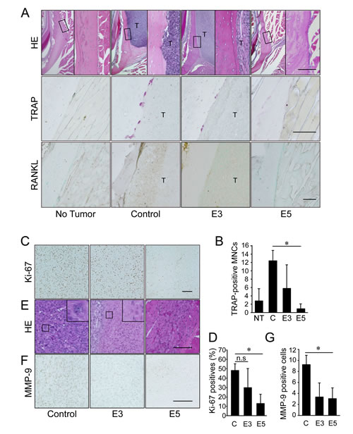 Early treatment with IMD-0560 reduced bone invasion by inhibiting osteoclastogenesis.