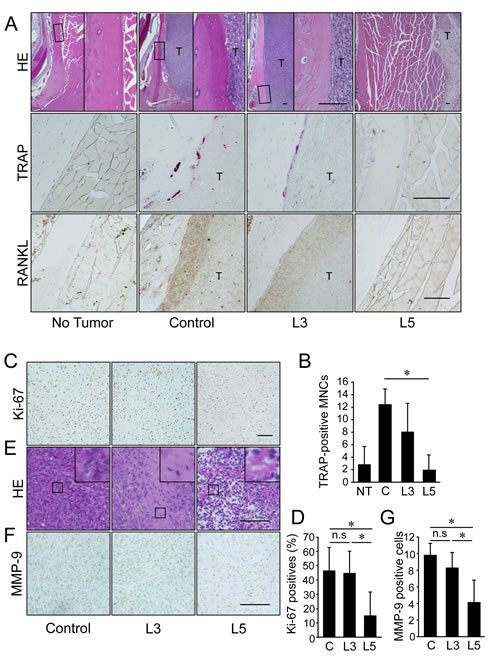 IMD-0560 injection was useful for the treatment of bone invasion by SCCVII cells via the inhibition of osteoclastogenesis.