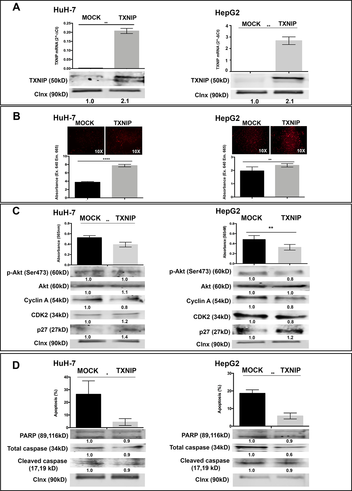 The effect of TXNIP overexpression on ROS levels, proliferation, apoptosis of HCC cells.