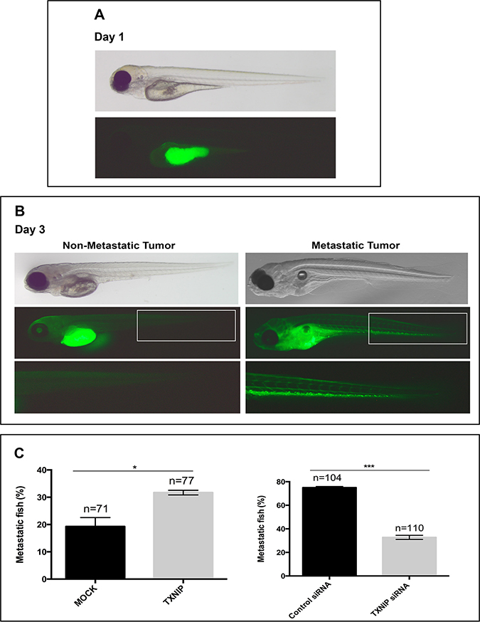 Regulatory effects of TXNIP on metastatic ability of HCC cells in zebrafish embryos.