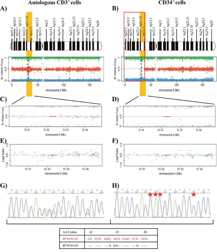 Results of SNP array on chromosome 6 and of the HLA Sanger sequencing of the patient 10.