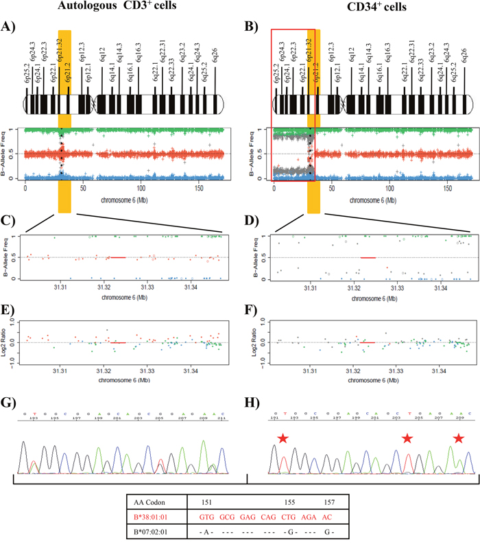 Results of the SNP array on chromosome 6 and the HLA Sanger sequencing of the patient 22.