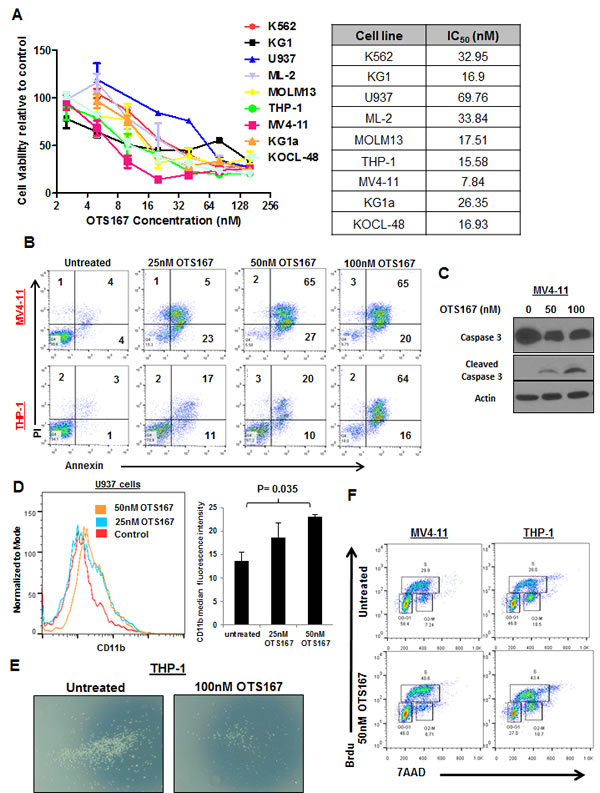 MELK inhibitor OTS167 exhibits anti-leukemia activity in AML cell lines.