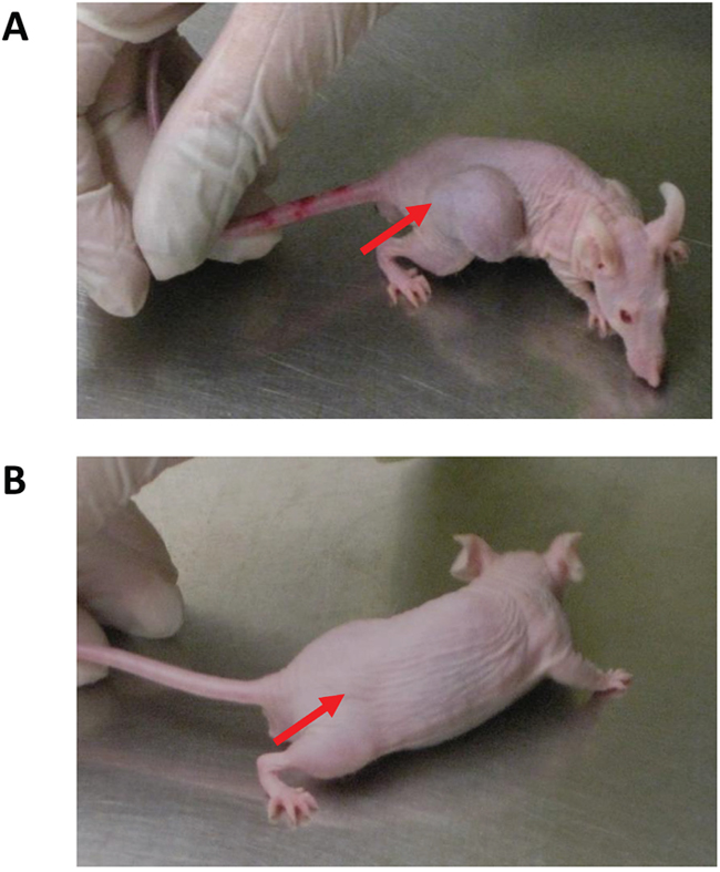 Visual differences of transdermal NEO412 on MGMT-negative melanoma.