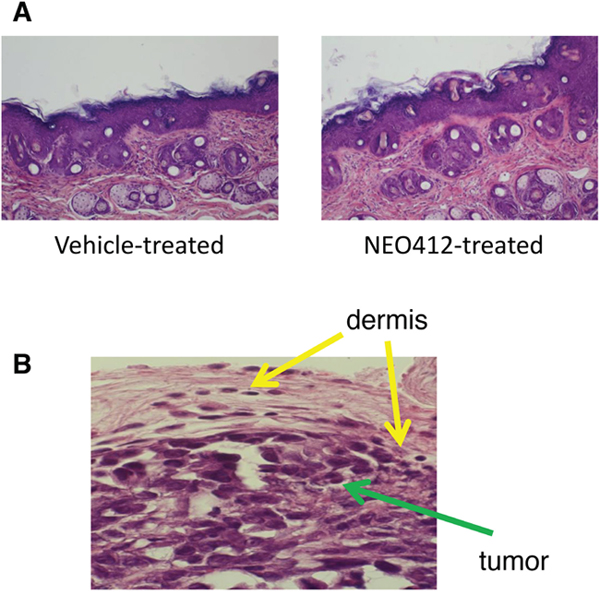 Microscopic evaluation of NEO412-treated skin as compared to vehicle-treated skin.