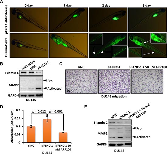 Filamin C inhibited the metastasis of cancer cells through downregulating MMP2.