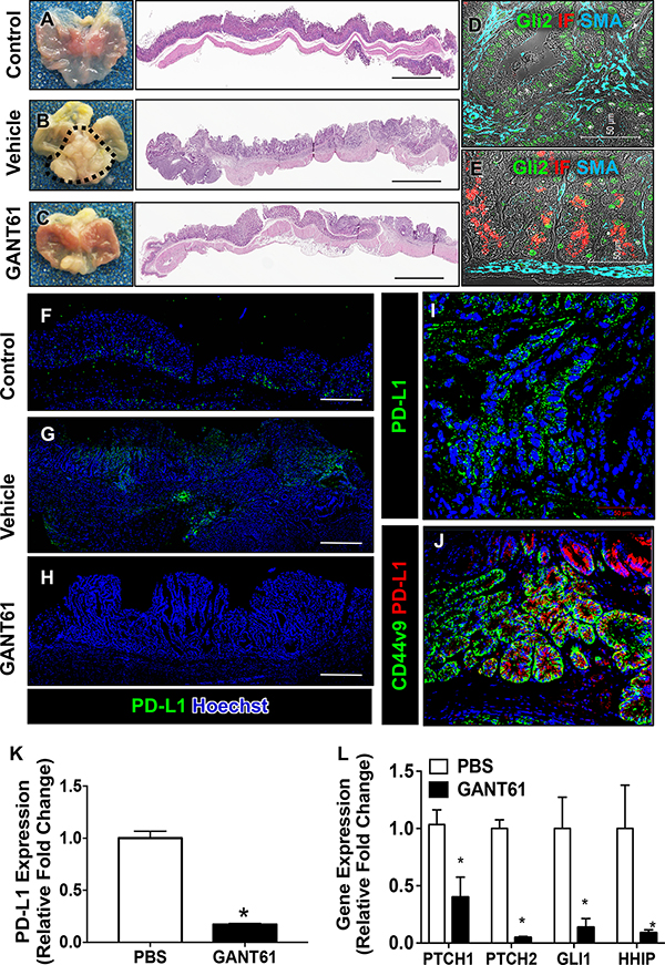 Histological changes and PD-L1 expression in iLgr5;GLI2A mice treated with GANT61.