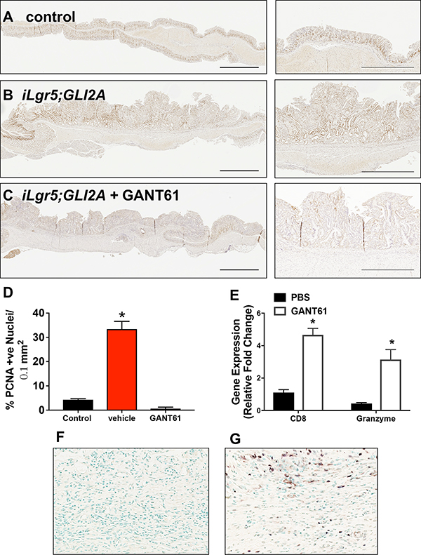 Changes in epithelial and tumor cell proliferation in iLgr5;GLI2A mice treated with GANT61.