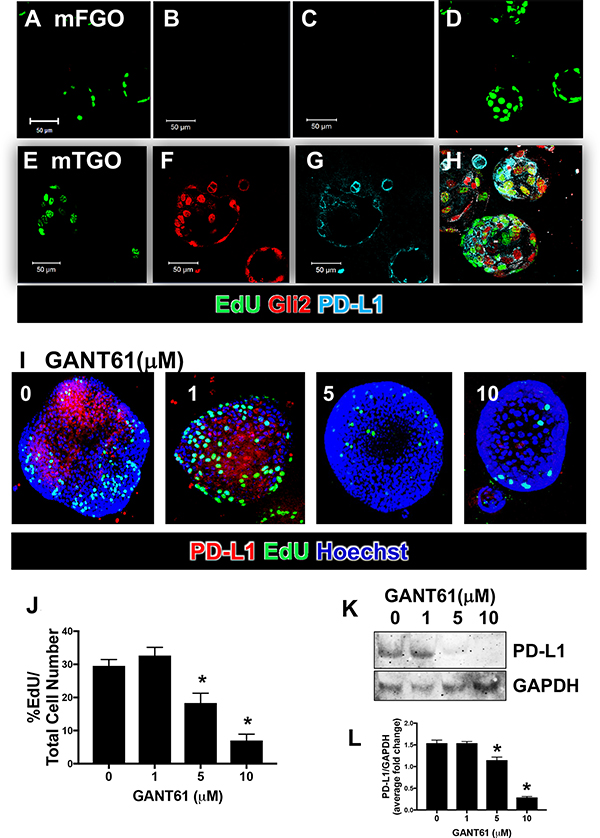 Gli2 and PD-L1 expression in gastric cancer organoids derived from iLgr5;GLI2A mice.