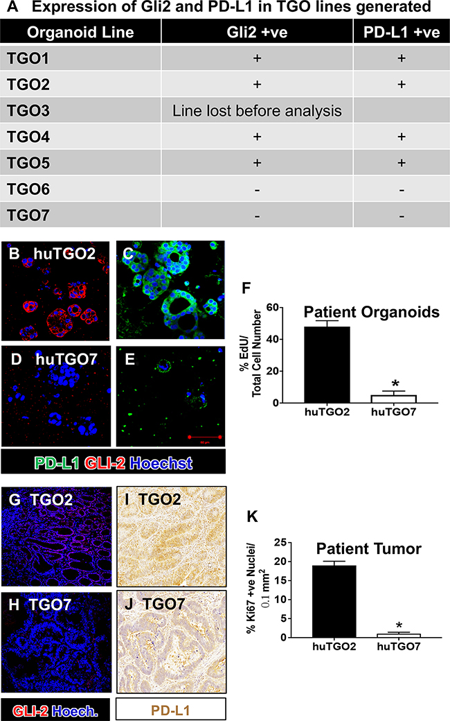 Expression of Gli2 and PD-L1 in huTGO lines and patient tumor tissue.
