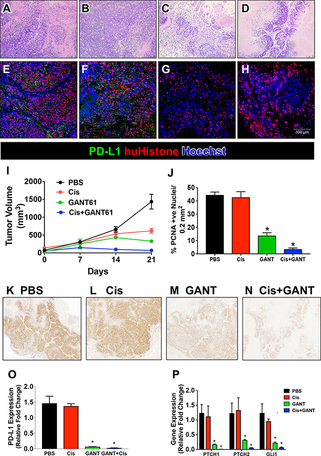 Xenograft mouse model developed using human-derived gastric cancer organoids (huTGO2).