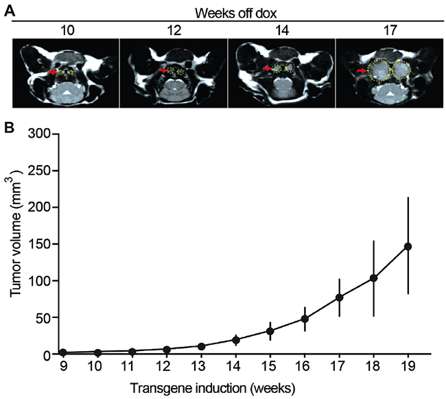 Mouse MTC tumor growth monitored in vivo by MRI.