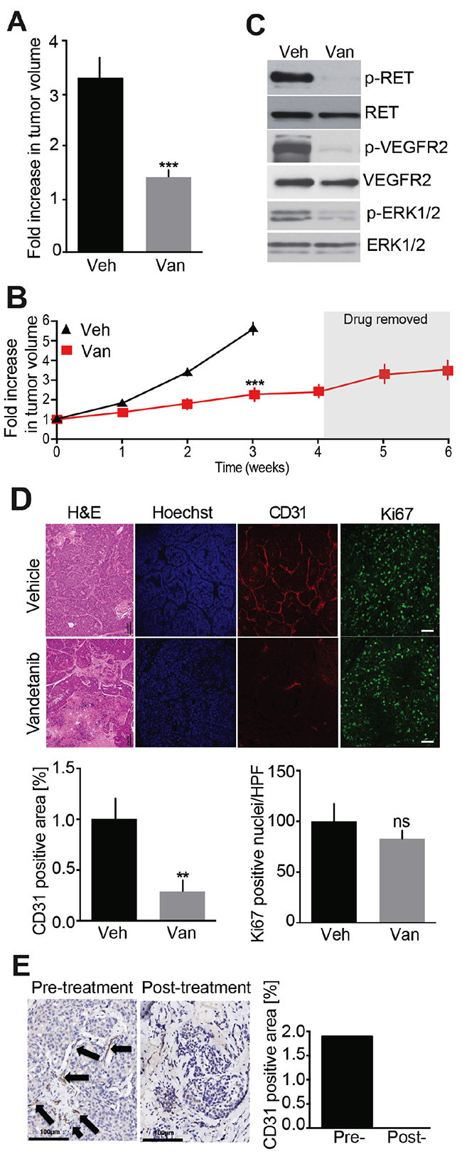 Evaluation of Vandetanib anti-tumor effect in a MTC mouse model.