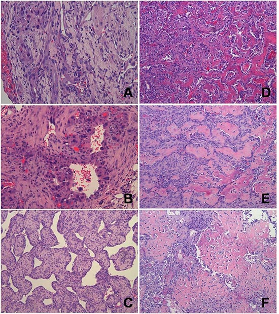 Representative histology of vascular and perivascular tumors of RGKO-p53&#x2212;/&#x2212; mice and of osteosarcomas of RGKO-p53+/&#x2212; mice.
