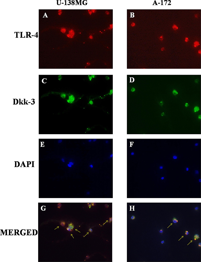 Role of TLR-4 in the modulation of Wnt/Dkk-3 axis.