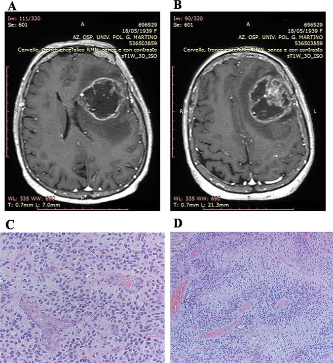 Patients magnetic resonance study and histologic features of biopsies.