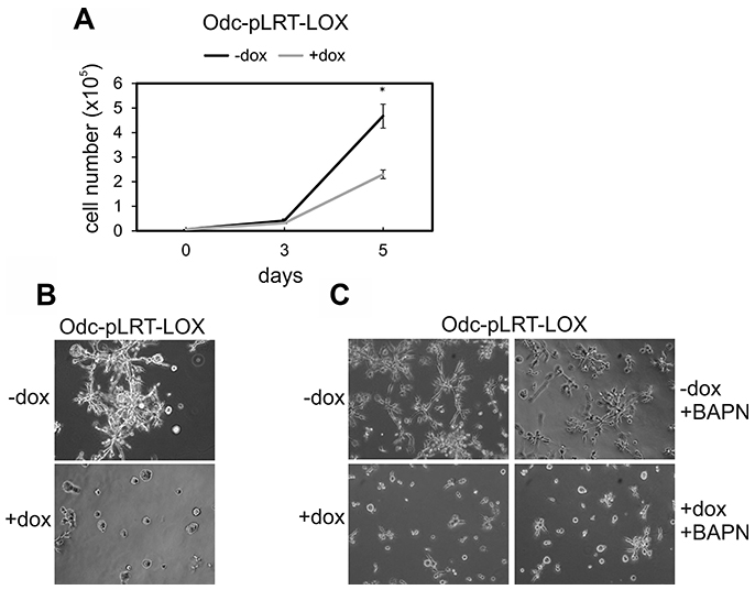 Effect of ectopic LOX expression on cell growth and invasion of ODC-transformed fibroblasts transfected with a tetracycline-inducible expression system (Odc-pLRT-LOX).