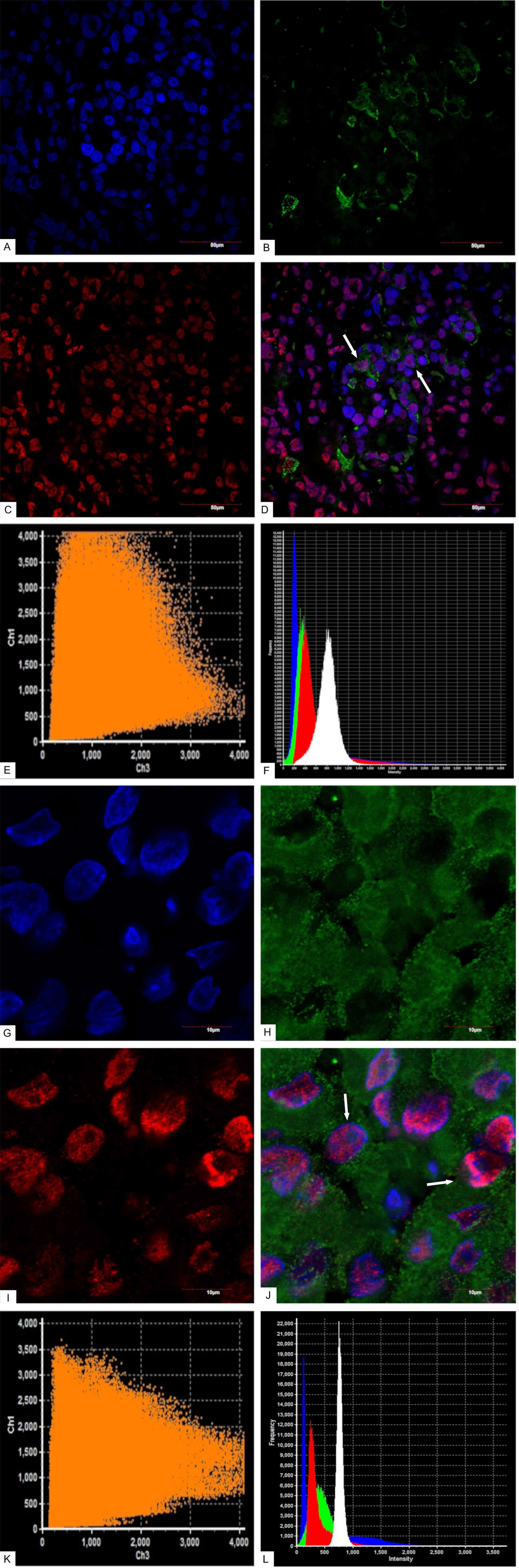 Confocal laser scanning microscopy, mammosomatotropinoma &#x2116;1.