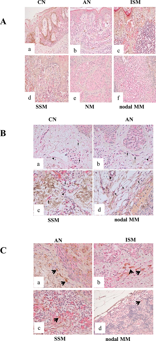 &#x03B2;3-ARs expression in human samples.