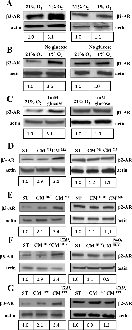 &#x03B2;-ARs expression in melanoma cells under various microenvironmental conditions.