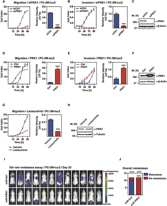 PRK1 controls migration and invasion of androgen-independent prostate cancer cell lines and determines development of metastases in vivo.