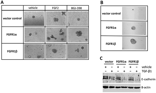 Effects of overexpression of FGFR1&#x03B1; and FGFR1&#x03B2; on cell transformation.