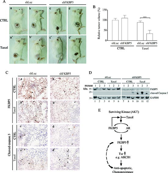 Sensitization to taxol by combined shFKBP5/taxol treatment in SCID mice xenografts.