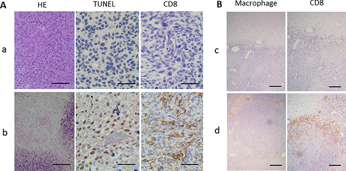 Histopathological analyses of the tumors obtained at 2 weeks after treatment initiation.