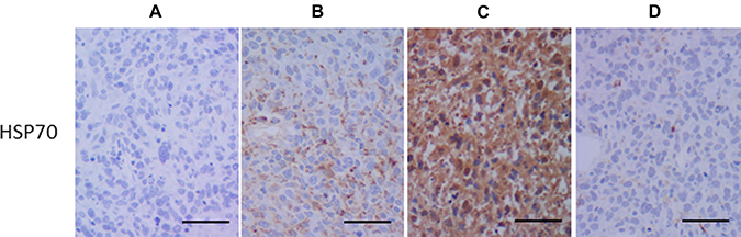 Immunohistochemistry for heat shock protein-70 (HSP70).