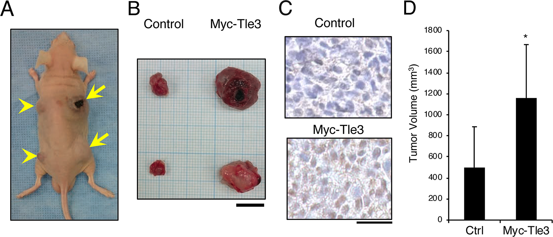 Overexpression of Myc-Tle3 in subcutaneously injected B16 melanoma cells increases tumor size in vivo.