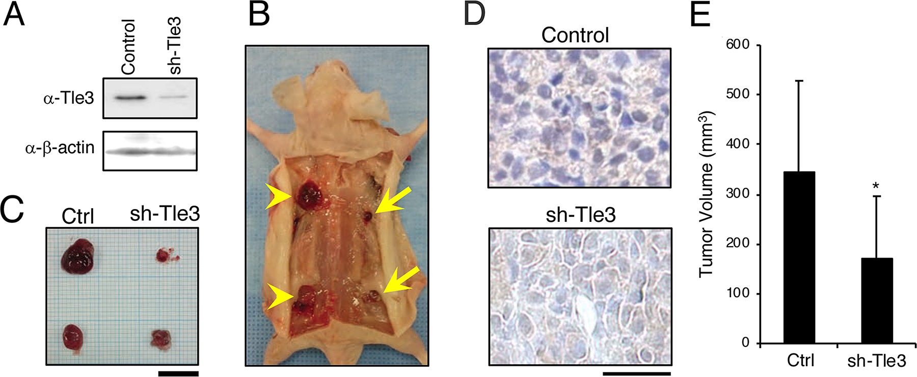 Knockdown of Tle3 in subcutaneously injected B16 melanoma cells decreases tumor size in vivo.