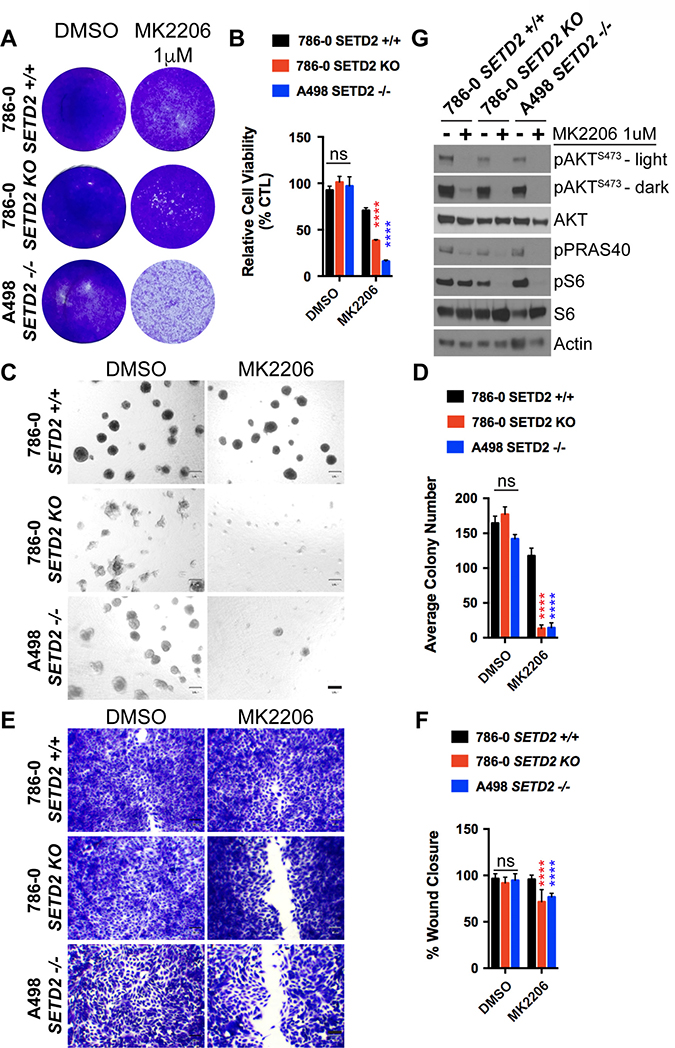 Figure 5: AKT-specific inhibitor MK2206 decreases cell viability, spheroid formation, and migration of  SETD2 deficient ccRCC-derived cells. (A)