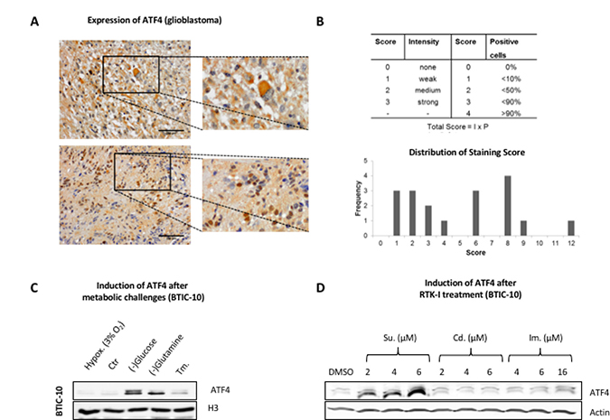 ATF4 protein expression in human resection material and response to metabolic challenges and RTK-Is in vitro.