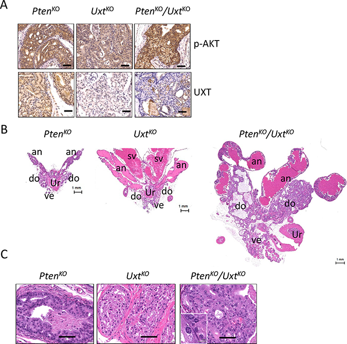 Analysis of PtenKO, UxtKO, and Pten/Uxt double KO mice.