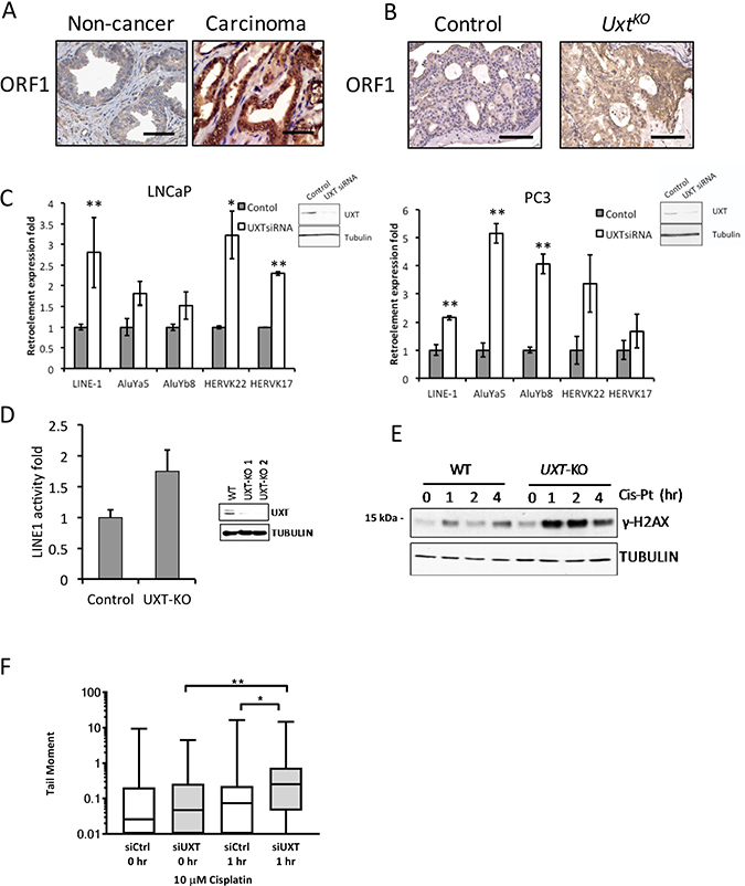 Loss of UXT in prostate promoted LINE-1 retroelement expression and retrotransposition.