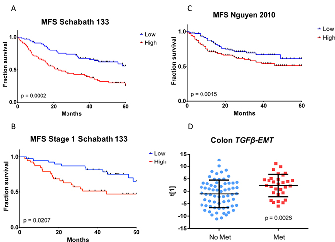 Kaplan&#x2013;Meier metastasis-free survival analysis of TGF&#x03B2;-EMT signature in fresh frozen samples.