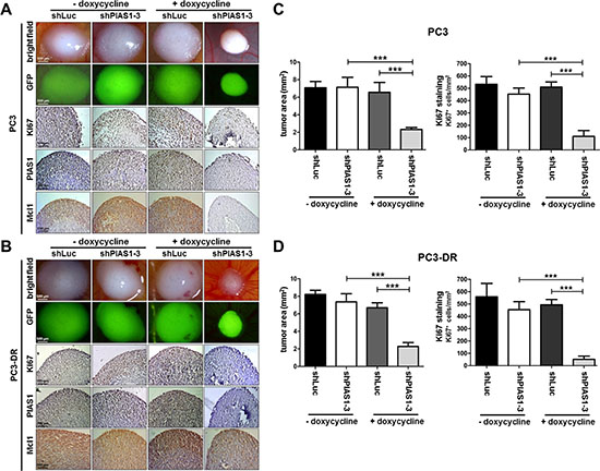 PIAS1 knockdown influences proliferation and tumor growth of PC3 and PC3-DR CAM onplants in vivo.