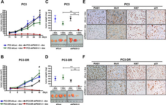 PIAS1 knockdown results in significantly reduced tumor growth of PC3 and PC3-DR xenografts in vivo.