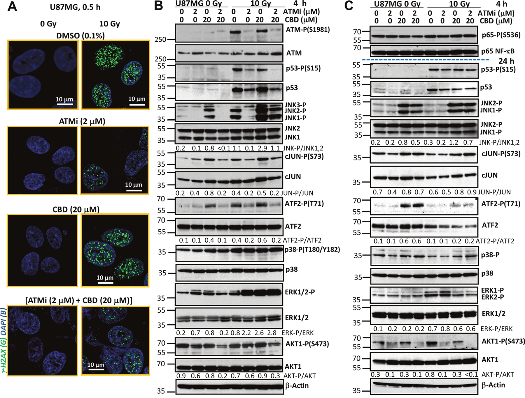 Effects of ATM kinase inhibition on radiation response of U87MG GBM cells.