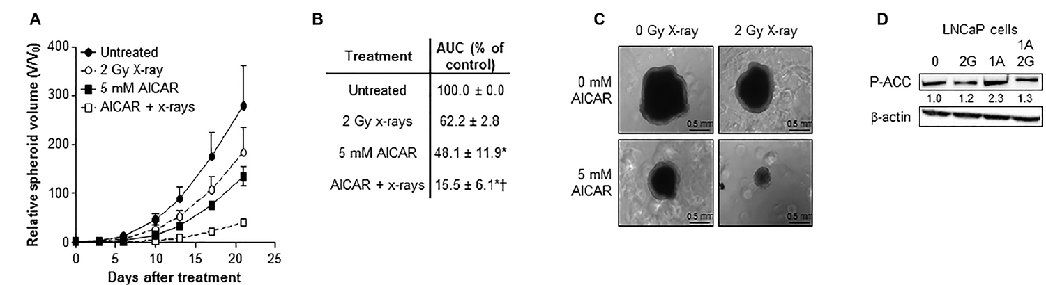 Combination of AICAR and ionizing radiation in LNCaP cells.