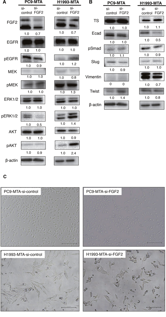 Effects of FGF2 knockdown on signaling pathway molecules and EMT marker proteins in the parental and pemetrexed-resistant lung cancer cells.