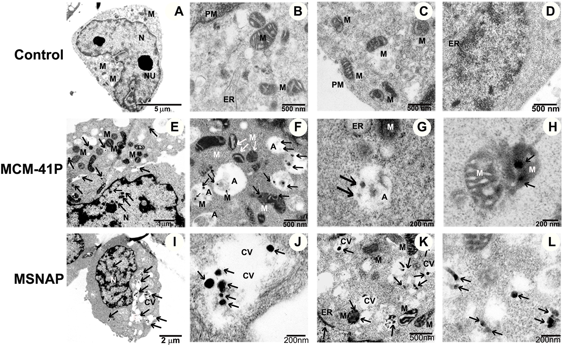 Subcellular localization of MCM-41 and MSNAP.