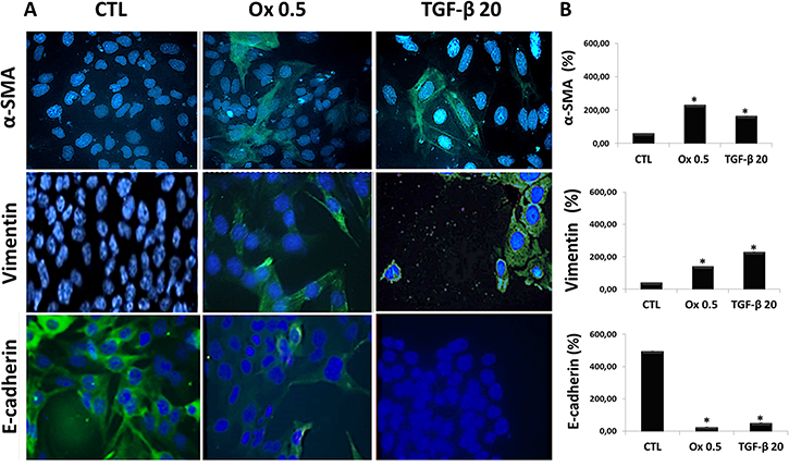 Markers of epithelial to mesenchymal transition in vitro.