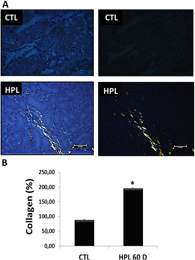 Evaluation of fibrotic marker in vivo.