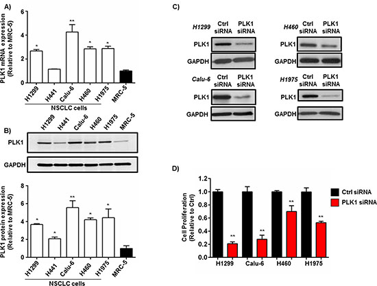 PLK1 expression in NSCLC cells and the effect of PLK1 knockdown on NSCLC cell proliferation.