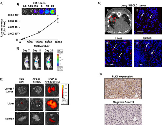 Establishment of a NSCLC bioluminescent mouse model and iNOP-7 siRNA delivery in vivo.