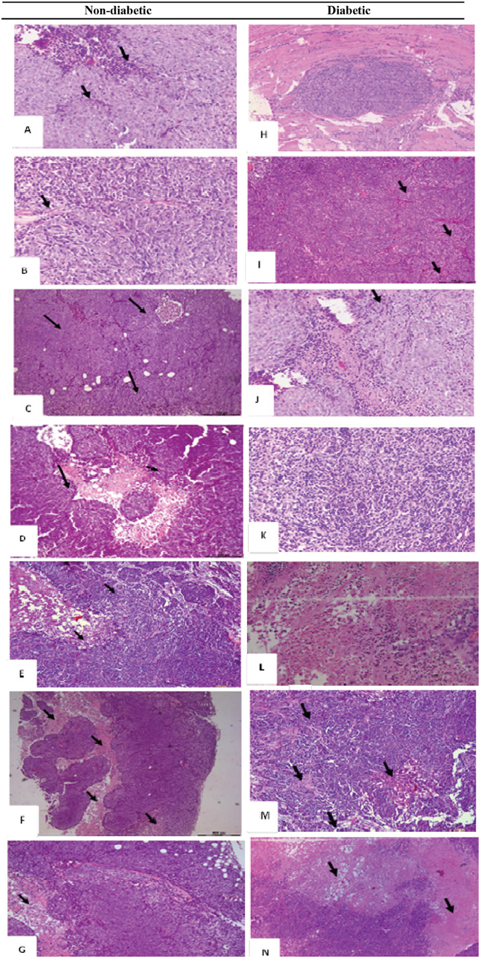 H&E histological examination of the representative HCT116 xenograft tumors in the different groups.